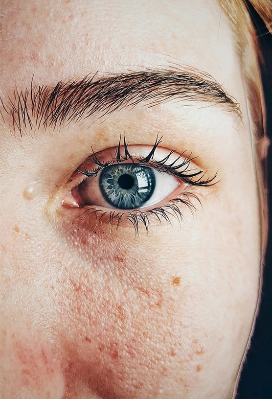 Laser eye surgery consultation at Belterra Eyecare